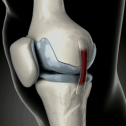 30 Flastera protiv bolova – potpuno prirodni